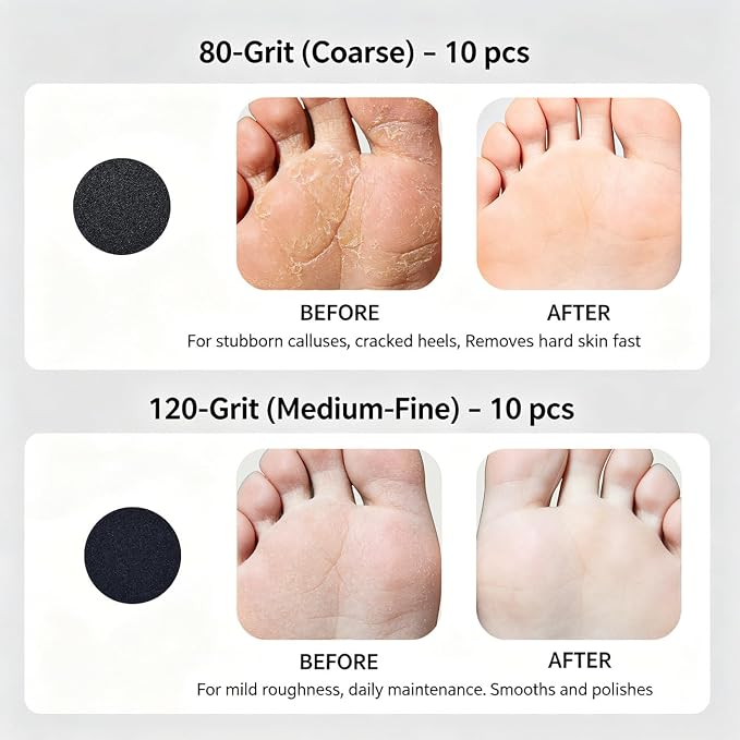 Electric Foot Callus Remover and Nail Drill Kit, 90° Foldable Rechargeable Pedicure Tool for Dead Skin, Cracked Heels, Shaping Nails, Gel Polish Removal, Professional Home Manicure Pedicure