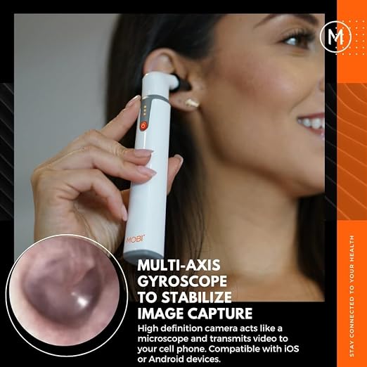 MOBI Smart Otoscope for Ears, Nose & Throat, 1080P HD Ear Camera with App for Adults & Kids, Rechargeable Digital Otoscope with 6 LED Lights, Multi-Axis Gyroscope & 3 Speculum Tips