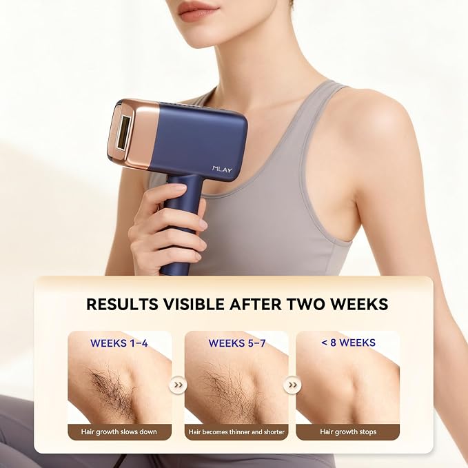 MLAY T14 IPL Epilator – 96.39% Hair Reduction in 4 Weeks, 500 Million Flashes, Pain-Free with Cooling System (Not a Laser), Suitable for All Skin Types, Blue