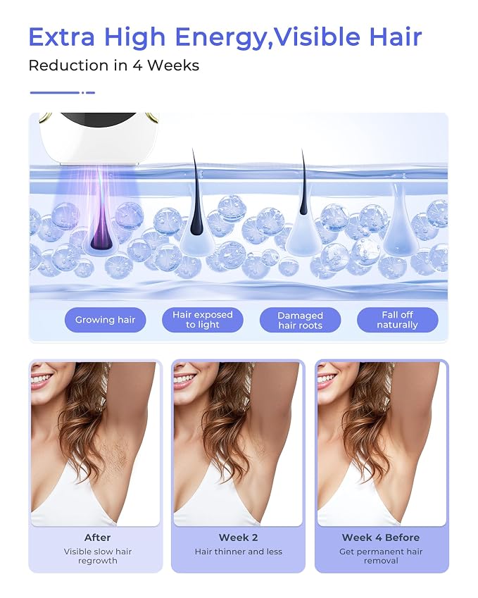 Laser Hair Removal for Women and Men, Air 15 Ice-cooling IPL Device Hair Removal for Nearly Painless & Long-Lasting Results From Home, 3 Modes & Auto Flashing for Fast Full Body Hair Removal