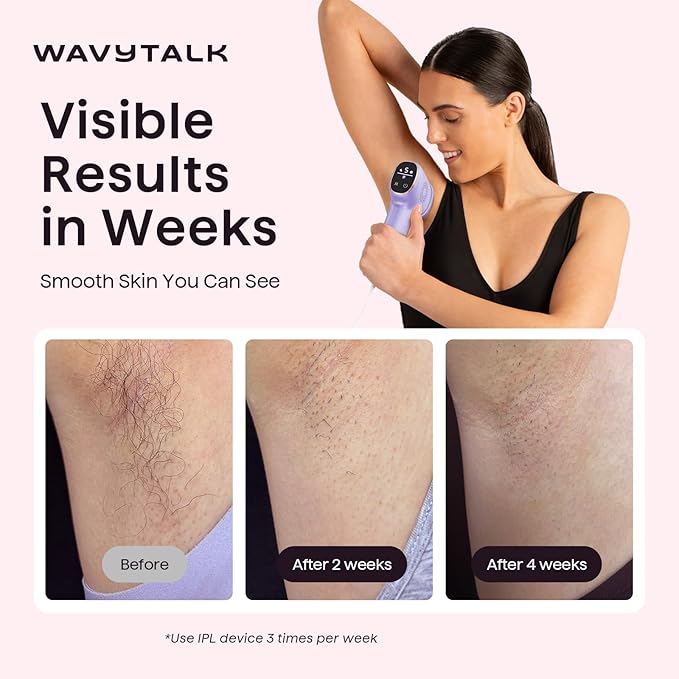 Wavytalk IPL Hair Removal Device, Bare It with Precision Roller for Face Body Bikini – Long-Lasting Result & Painless, 24J Dual-Pulse & Ice Cooling, At-Home Use for Women and Men, Corded