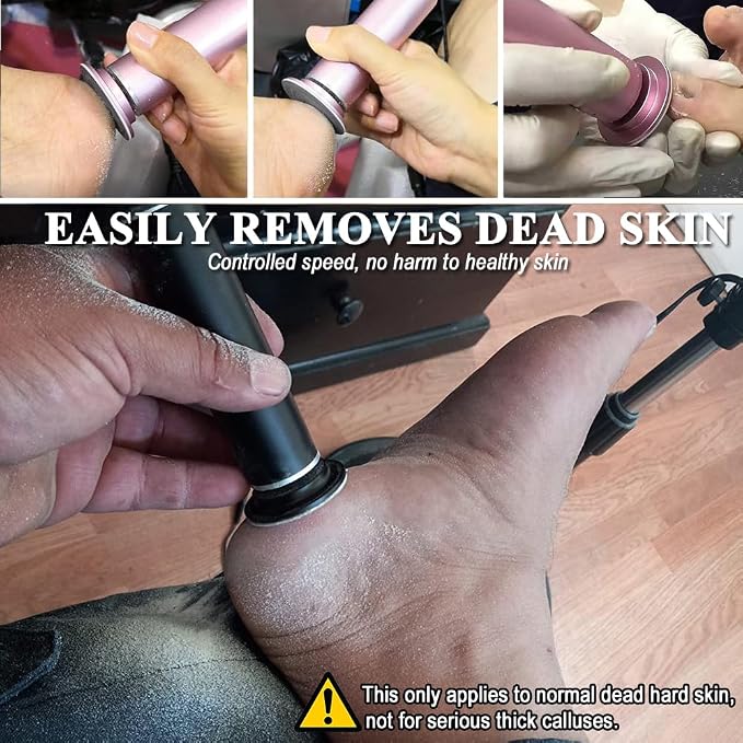 Electric Callus Remover for Feet, Adjustable Various Speed, Powerful Electric Foot File Sander Grinder Pedicure Hard Dead Skin Remover with 60 Sandpaper Discs and Dust Brush, Black FCR-1