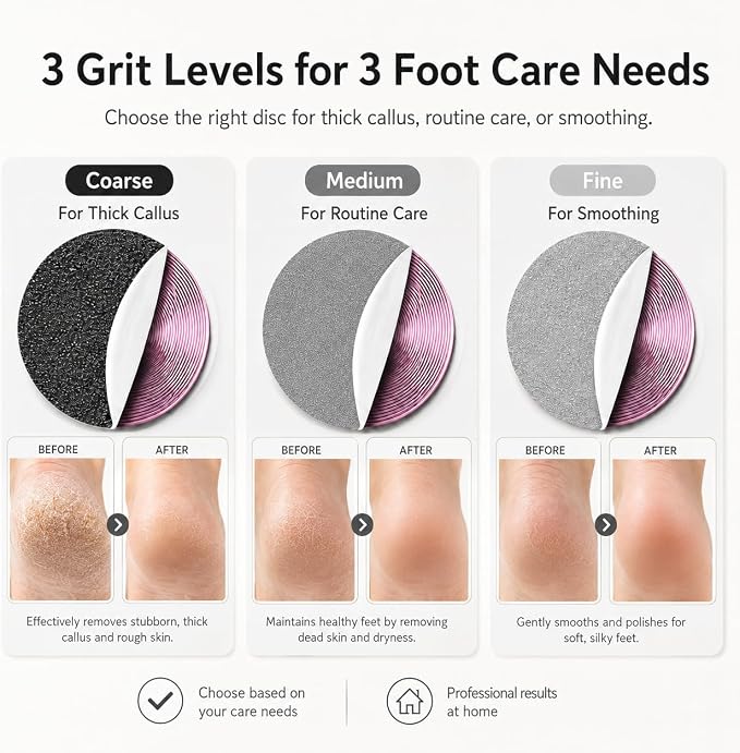SUFU SUFU 2 in 1 Electric Foot Callus, USB Rechargeable Electric Foot File Grinder with Digital Display, Cordless Aluminum Pedicure Tools for Feet,Nail Care,Dead Skin (Pink)