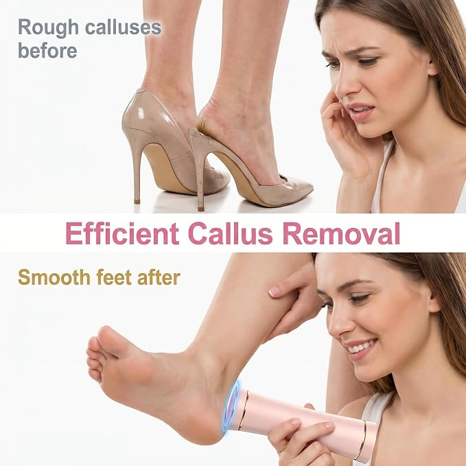 Electric Callus Remover, Rechargeable Foot File Home Use | 2000mAh Rechargeable, IPX7 Waterproof, 20 Diamond Rollers, for Dry Skin & Home Pedicure