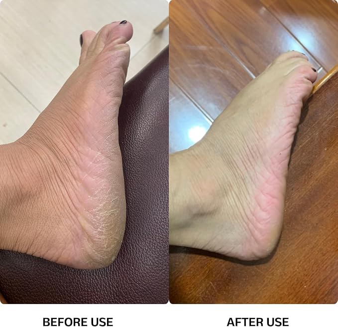 High Power Electric Foot Callus Remover, 2025 Upgrade with 100-inch Extra-Long Cord and 60 Replaceable Sandpaper Discs, Electric Foot File for Cracked Heels and Dead Skin, Rose Pink