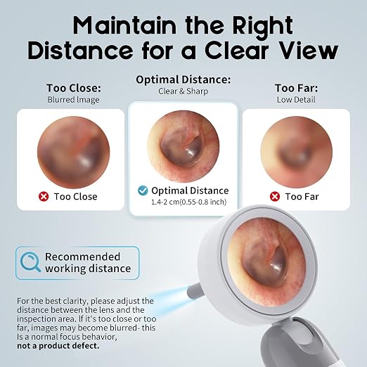 1080P HD Otoscope Ear Camera for Family, Medical Grade 1.38" Screen, Telemedicine Ready, 12 Silicone Tips and 3 Adhesive Ear Sticks, Photo/Video, Type-C Charging, Home Medical | 1.38" Screen for real-time viewing. Capture photos and videos, Connect to ...