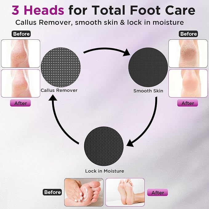 Electric Foot Callus Remover, Apply Oil,Foot File,Reusable Nano-Glass Head, Ergonomic Premium Aluminum Callus Remover for feet, Professional Foot SPA Pedicure Tool at Home