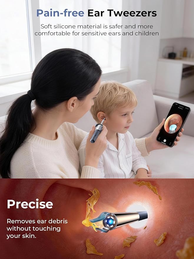 Ear Wax Removal Kit: I35R Ear Cleaner with Flexible Ear Camera Otoscope- Visual Ear Pick Tweezers Wax Remover - Ear Cleaning Kit 3 Pieces Inspection Tools for Family