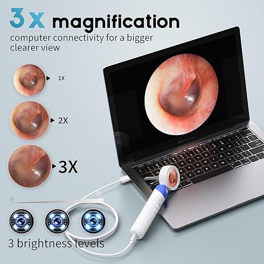 1080P HD Otoscope Ear Camera for Family, Medical Grade 1.38" Screen, Telemedicine Ready, 12 Silicone Tips, Photo/Video, Type-C Charging, Home Medical（Blue）