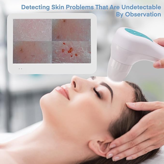 Beauty Star Scalp Analysis Machine, 12 inches Skin Tester Diagnosis Digital Analyzer Tool, Profesional Hair Detector Microscope, HairFollicle Health Detection Camera for Head Spa, Salon and Home Use