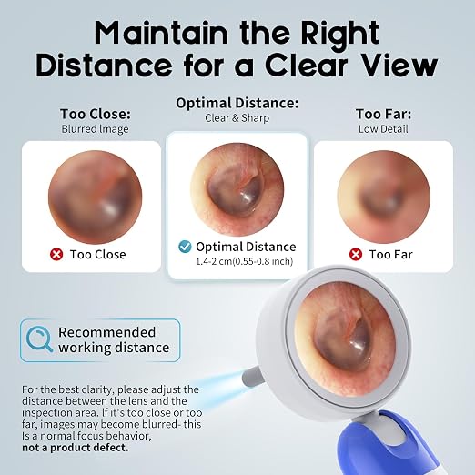 1080P HD Otoscope Ear Camera for Family, Medical Grade 1.38" Screen, Telemedicine Ready, 12 Silicone Tips, Photo/Video, Type-C Charging, Home Medical（Blue）