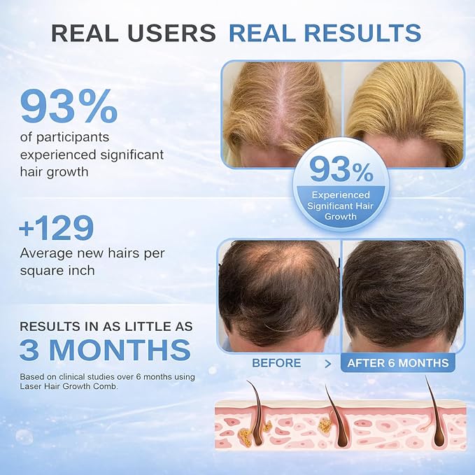Obiredk ㅤLaser Hair Growth Comb, 650nm Red Light Therapy for Hair Regrowth, FDA Cleared LLLT Scalp Massager for Thinning Hair & Receding Hairline Rechargeable - White