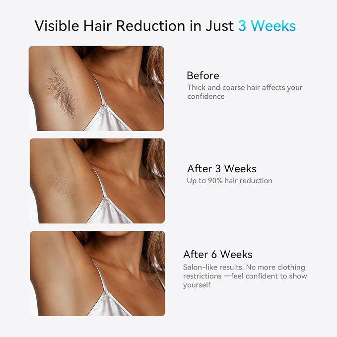 Laser Hair Removal LIJAI IPL Hair Removal Device for Women & Men, 999,999 Flashes Painless Long-Lasting Results, at Home Hair Removal in 8mins for Armpits Legs Arms Bikini Line, Silver