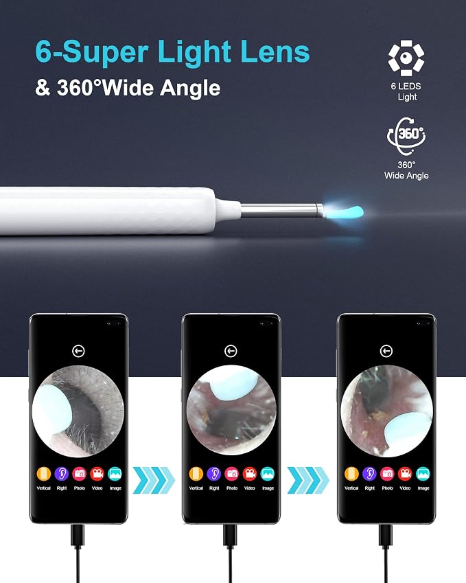 DJROLL Ear Wax Removal Endoscope, Earwax Remover Tool, Ear Camera,1080P FHD Wireless Ear Otoscope with 6 LED Lights,Ear Scope with Ear Wax Cleaner Tool for iPhone, iPad & Android Smart Phones (White)