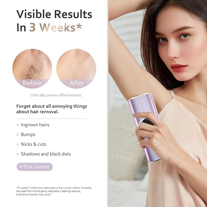 BeautyGlow Laser Hair Removal Device for Women, At Home IPL Hair Remover with Ice Cooling Technology for Face and Body, Painless & Long-Lasting Results
