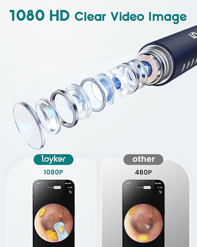 Loyker Ear Wax Removal, Ear Cleaner with 1080P Camera, Ear Cleaning Kit with 12 Ear Pick, Visual Ear Picker Earwax Remover Tweezers with 6LED Light, Ear Camera for iPhone, iPad, Android Phones, Blue