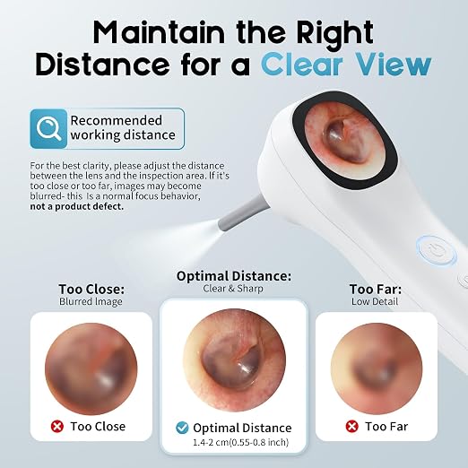 Otoscope Ear Camera with 1.21” Screen, 1080P Ear Scope with 4 LED Lights, Otoscope Camera for Adults, Support Photo & Video, Type-C Charging with Computers, Baby Essentials, Home Medical | 1.21" Screen for real-time viewing. Capture photos and videos, ...