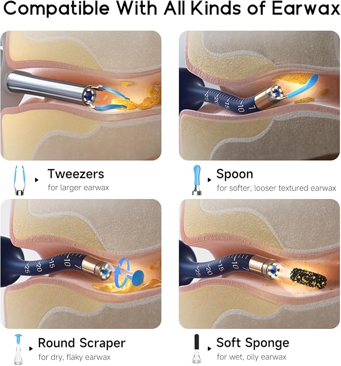 BEBIRD Ear Wax Removal Tool Camera, Visual Earwax Cleaner with Cleaning Kit as Spade/Spoon/Pick/Tweezer Clean Ears for Family, Ear-Scope Otoscope Wireless WiFi Connect