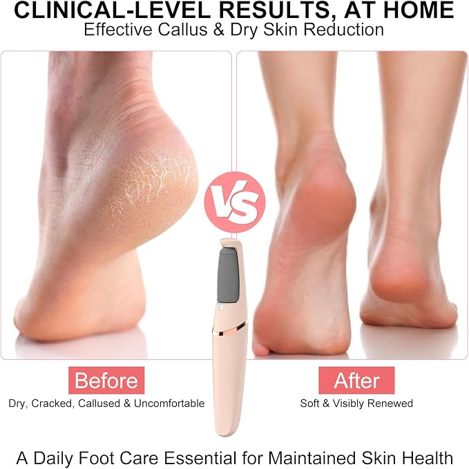 Electric Foot File, Callus Remover for Feet - Rechargeable Pedicure Tool, 2 Speeds 1700/2000 RPM & 2 Heads for Dry & Dead Cracked Skin, Cordless Waterproof Hard Skin Removal, Home Pedicure Gift