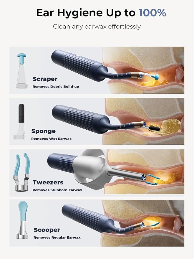 Ear Wax Removal Kit: I35R Ear Cleaner with Flexible Ear Camera Otoscope- Visual Ear Pick Tweezers Wax Remover - Ear Cleaning Kit 3 Pieces Inspection Tools for Family