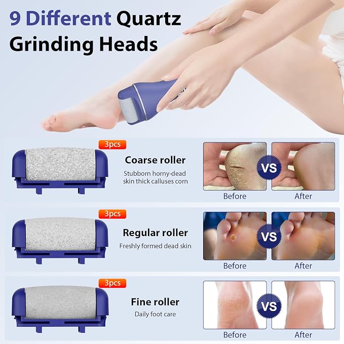 AdamPark Electric Callus Remover for Feet, Rechargeable Portable Electronic Foot Callus Remover 2-in-1 Wet/Dry Foot Scrubber Electric Toot File for Hard Cracked Dry Dead Skin（Blue）