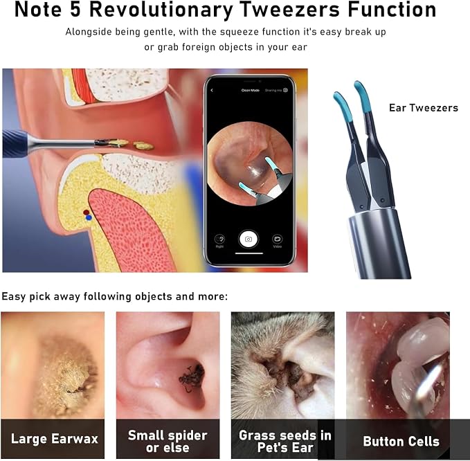 Note5 Ear Wax Removal Kit with Camera,10MP Ear Cleaner Camera Otoscope with Light,Real-time Remote Video with Ear Pick & Tweezers,12 Pcs Ear Scoops for Whole Family