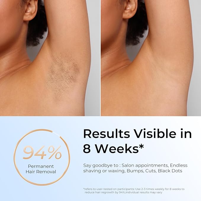 Finequin Laser Hair Removal, IPL Laser Hair Removal for Women and Men Permanent, Hair Removal Device with 3.0 IPL Red Light Wave, Home Laser Hair Removal Device for Facial Legs Armpits Bikini Body Use