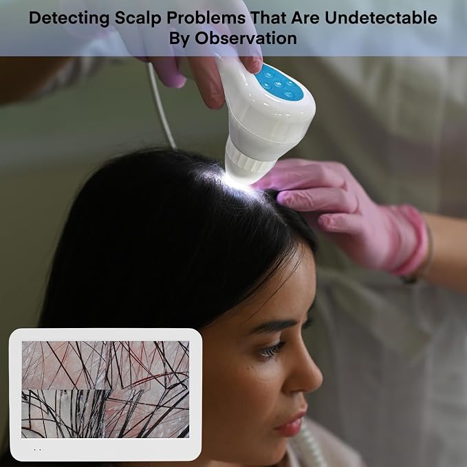 Beauty Star Scalp Analysis Machine, 12 inches Skin Tester Diagnosis Digital Analyzer Tool, Profesional Hair Detector Microscope, HairFollicle Health Detection Camera for Head Spa, Salon and Home Use