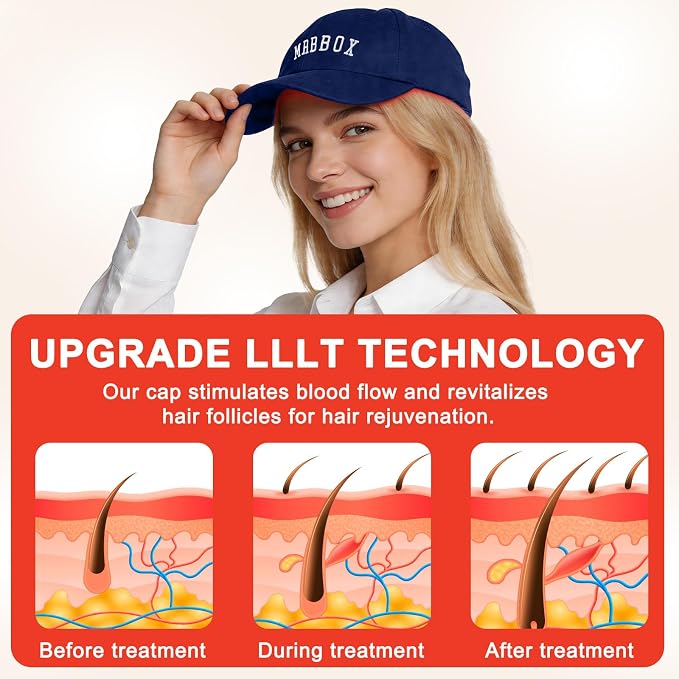 Red Light Therapy for Hair Growth,528 Total Light Emitters,Full-Scalp Coverage,660nm Red Light + NIR, At-Home Scalp Care,Red Light Hair Growth Cap (LP-RJVGRW-BLK)