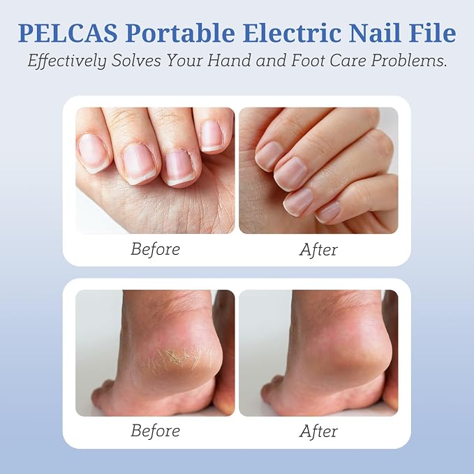 PELCAS Electric Nail File, 5 Speeds Manicure and Pedicure Kit, Cordless Nail Drill, Toenail Grinder for Thick Toenails with LED Light, Dremel Tool Kit for Human, Pet, Toenails, Natural & Acrylic Nails