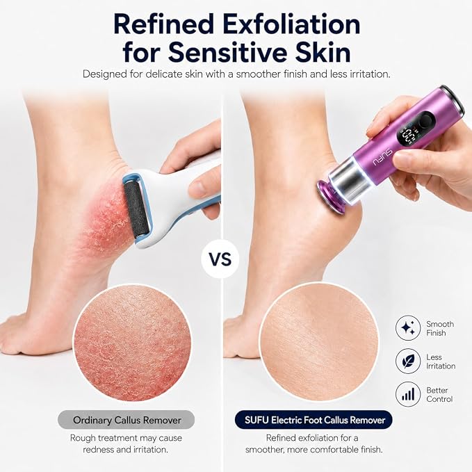 SUFU SUFU 2 in 1 Electric Foot Callus, USB Rechargeable Electric Foot File Grinder with Digital Display, Cordless Aluminum Pedicure Tools for Feet,Nail Care,Dead Skin (Pink)