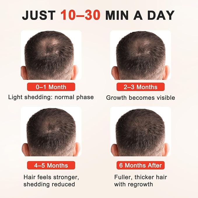 Red Light Therapy for Hair Growth for Men & Women,Red Light Hair Growth Cap,Full-Scalp Coverage,At-Home Scalp Care, Father‘s Day Gift Idea,Blue Cap