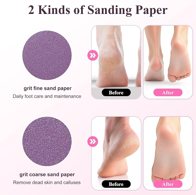Electric Foot Callus Remover Rechargeable, Portable Electronic Foot File Pedicure Tools, Waterproof Foot Scrubber File, Professional Pedicure Kits, Foot Care for Dead Skin Ideal Gift (White)