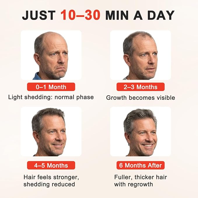 Red Light Therapy for Hair Growth,528 Total Light Emitters,Full-Scalp Coverage,660nm Red Light + NIR, At-Home Scalp Care,Red Light Hair Growth Cap (LP-RJVGRW-BLK)
