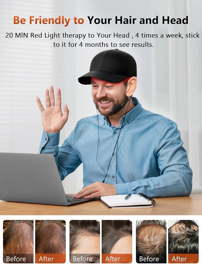 RELEXNOW Red Light Therapy Cap for Hair Growth, Infrared Red Light Therapy Hat for Men & Women Thinning Hair Regrowth with 660nm 850nm 940nm Wavelengths, Includes Timer & Controller