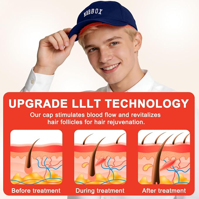 Red Light Therapy for Hair Growth,528 Total Light Emitters,Full-Scalp Coverage,Laser Hair Growth Cap,Blue