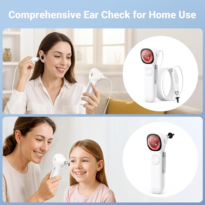 ScopeAround Otoscope with Light, 1.45" IPS Display Digital Otoscope, 3.9mm Ear Camera with Ear Wax Removal Tools, Ear Scope with Extention Cable, 6 LED Lights, Capture Photos Videos, White