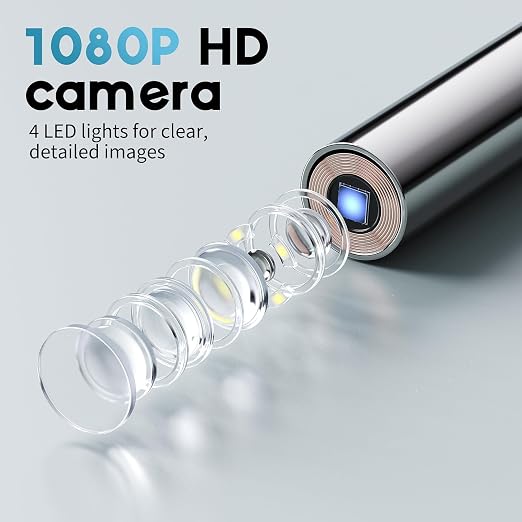 1080P HD Otoscope Ear Camera for Family, Medical Grade 1.38" Screen, Telemedicine Ready, 12 Silicone Tips and 3 Adhesive Ear Sticks, Photo/Video, Type-C Charging, Home Medical | 1.38" Screen for real-time viewing. Capture photos and videos, Connect to ...
