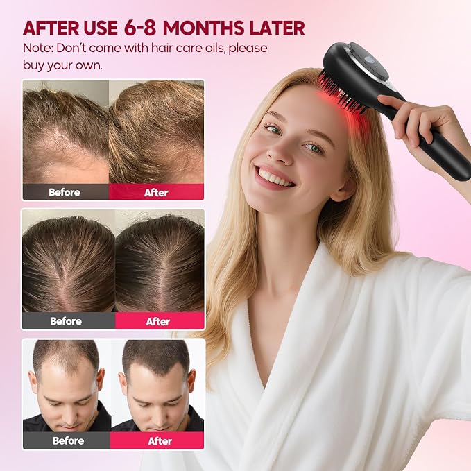 Morfone Upgrade 3 in 1 Electric Scalp Massager Brushes, Hair Oil Applicator, IPX7 Waterproof Scalp Massager Comb, Cordless & Portable Adjustable Modes for Men Women