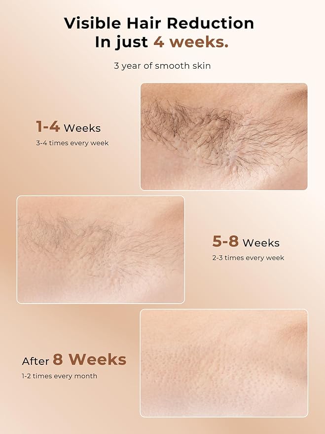 Ubroo Laser Hair Removal with 5℃ Ice Cooling,Hand-held Hair Removal Device IPL Hair Removal for Women and Men,Reduce Hair Regrowth,Full Body Use for Legs,Bikini,Armpits（Gold）