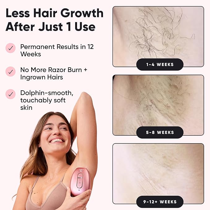 RoseSkinCo Lumi IPL Laser Hair Removal Device, At Home Permanent Hair Reduction on Face, Bikini, Legs, Arms, Underarms, Safe & Gentle Intense Pulsed Light Handheld Device, White/Gold