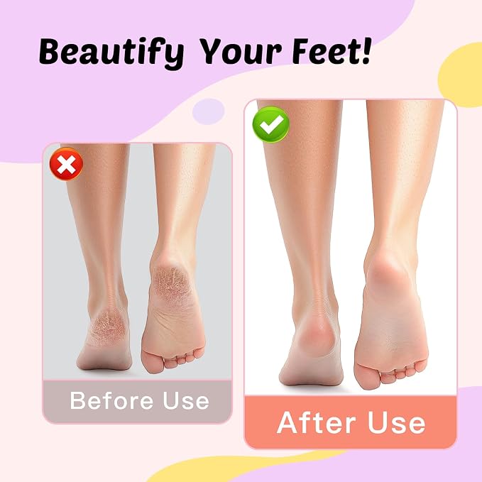Electric Foot Callus Remover, 9-Speed for Dead Skin & Hard Calluses, Aluminum Alloy, Type-C Rechargeable, Replacement Discs, Spa-Like At-Home Pedicure, Relaxing Self-Care (Deep Lavender)