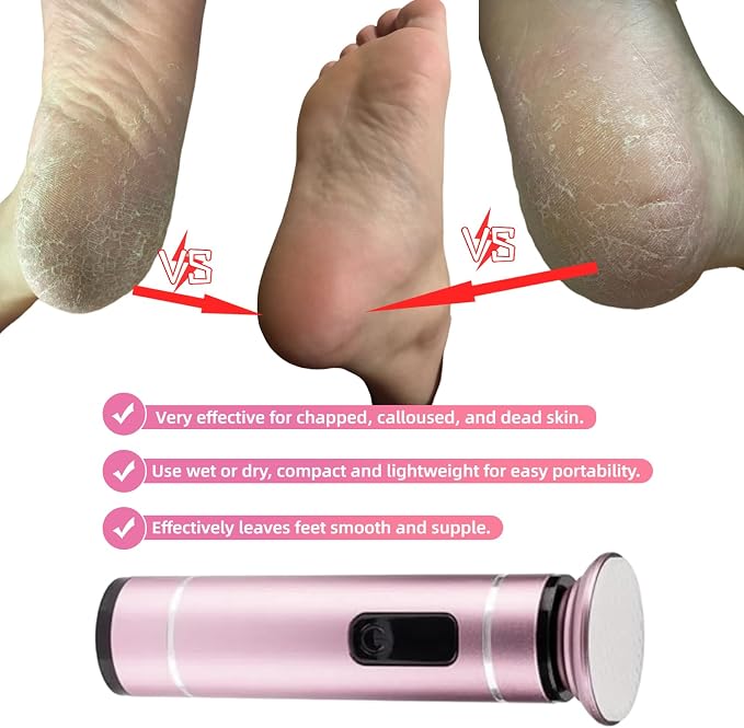 Electric Foot File Callus Remover Glass Grinding Head Electric Callus Remover for Feet Rechargeable Foot Grinder Dead Skin Pedicure Tools Adjustable Speed Foot Sander with Led Display