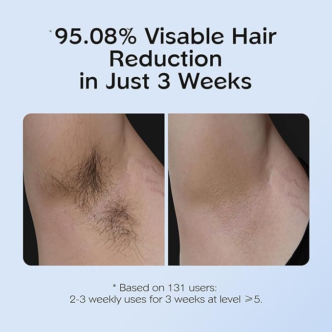 INNZA IPL Hair Removal with Ice Cooling Care Function for Women,Long-Lasting Results,999,999 Flashes Painless Hair Removal, Hair Removal Device for Armpits Legs Arms Bikini Line
