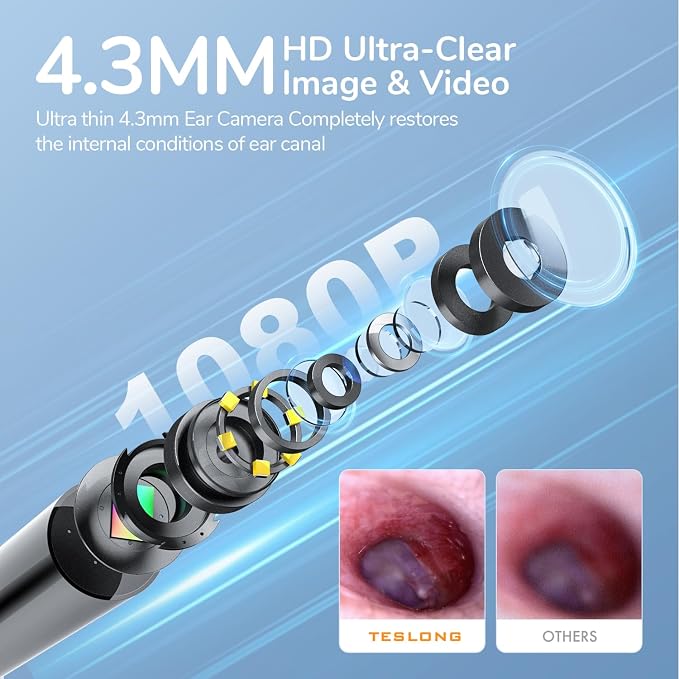 Teslong Digital Otoscope with Light, 1080p HD Ear Camera with Ear Wax Removal Tools, Video Ear Scope Otoscope with Light, Compatible with iPhone15, iPad, Android Phone, USB, Ear Picks, Waterproof