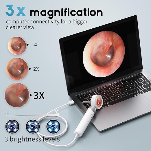 1080P HD Otoscope Ear Camera for Family, Medical Grade 1.38" Screen, Telemedicine Ready, 12 Silicone Tips and 3 Adhesive Ear Sticks, Photo/Video, Type-C Charging, Home Medical | 1.38" Screen for real-time viewing. Capture photos and videos, Connect to ...