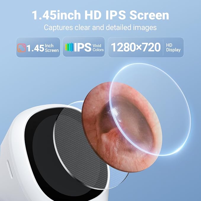 ScopeAround Otoscope with Light, 1.45" IPS Display Digital Otoscope, 3.9mm Ear Camera with Ear Wax Removal Tools, Ear Scope with Extention Cable, 6 LED Lights, Capture Photos Videos, White