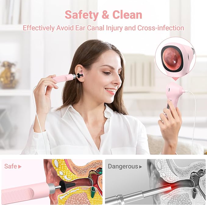 ScopeAround Digital Otoscope w/IPS Screen, 720p HD Smart Video Otoscope with Light, Ear Scope Otoscope with Camera Ear Wax Removal Camera, Ear Checker, Power On and Go, Pink