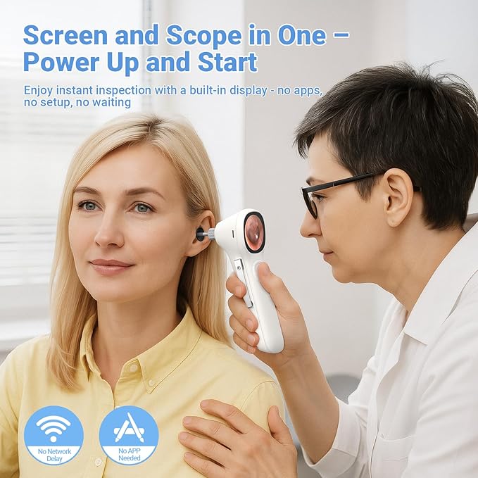 ScopeAround Otoscope with Light, 1.45" IPS Display Digital Otoscope, 3.9mm Ear Camera with Ear Wax Removal Tools, Ear Scope with Extention Cable, 6 LED Lights, Capture Photos Videos, White