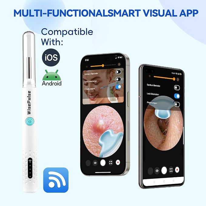 Smart Visual Ear Wax Removal Kit with Camera and Light,Professional Home Use HD Camera Ear Wax Removal，Vari Replacement Tips, Portable Ear Cleaning for iPhone, iPad, Android Phones (White)